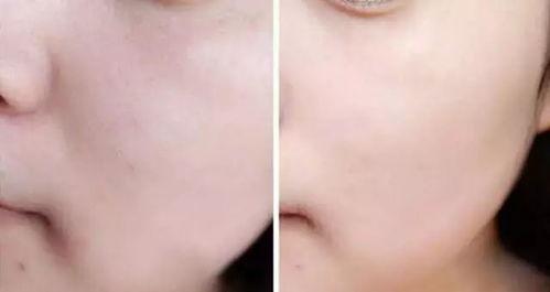 日本代购 子宫,探寻子宫健康之道