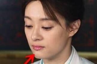 香港明星下巴有痣,痣痣生辉的下巴风采