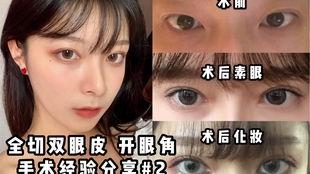 切双眼皮视频,打造迷人电眼魅力